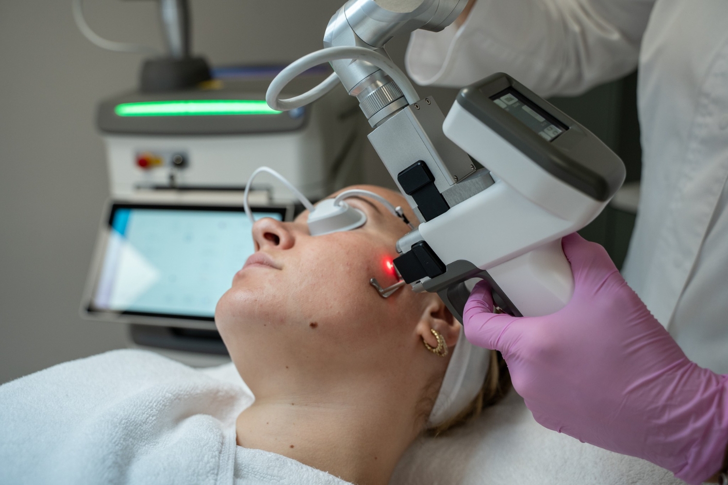Laserpeel Youlaser Prime MT